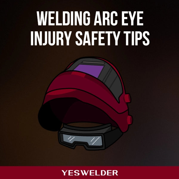 Welding Arc Eye Injury Prevention - Welding Safety Tips